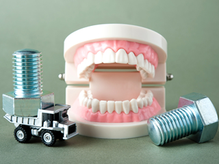 失った歯を補う「インプラント治療」とは？